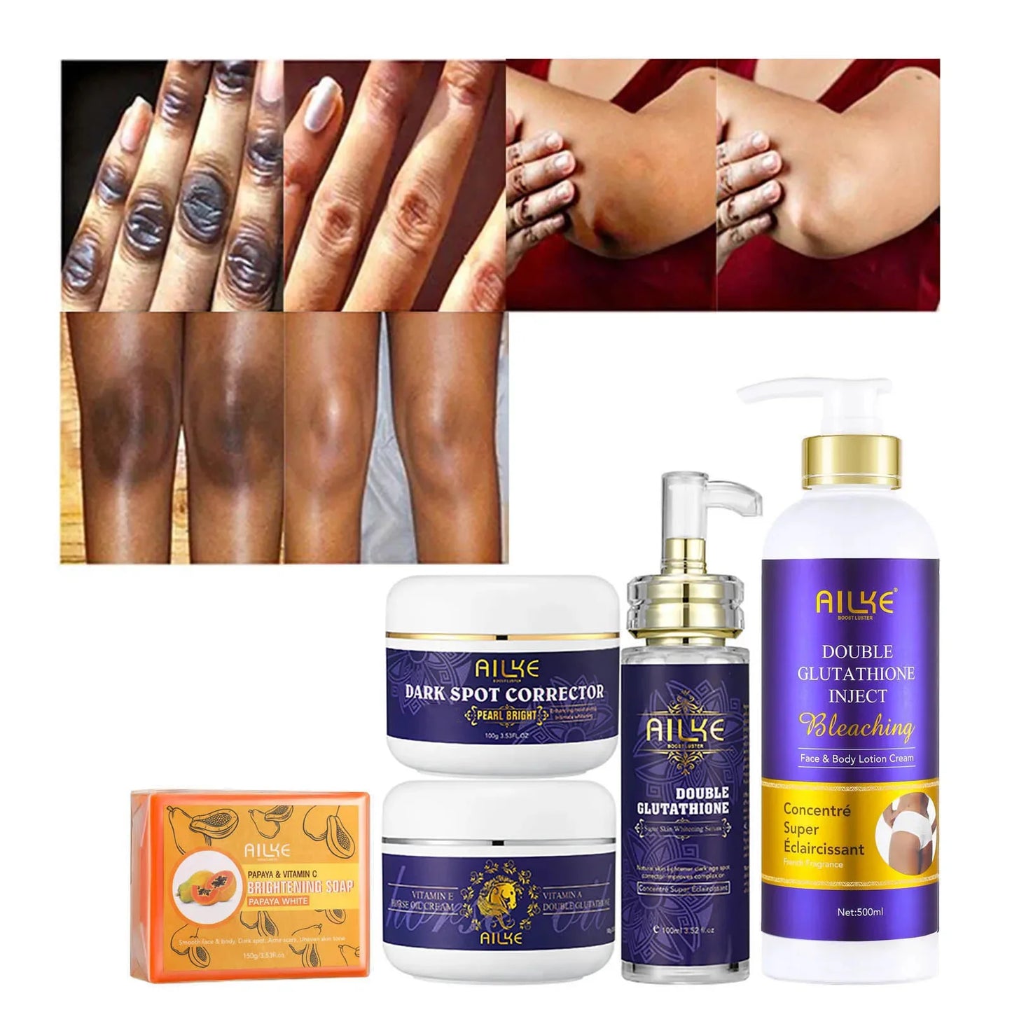 AILKE Whitening Skin Care, With Double Glutathione, Lightening, Moisturizing, Remove Dark Spots, Melanin, Skin Glowing Face Care